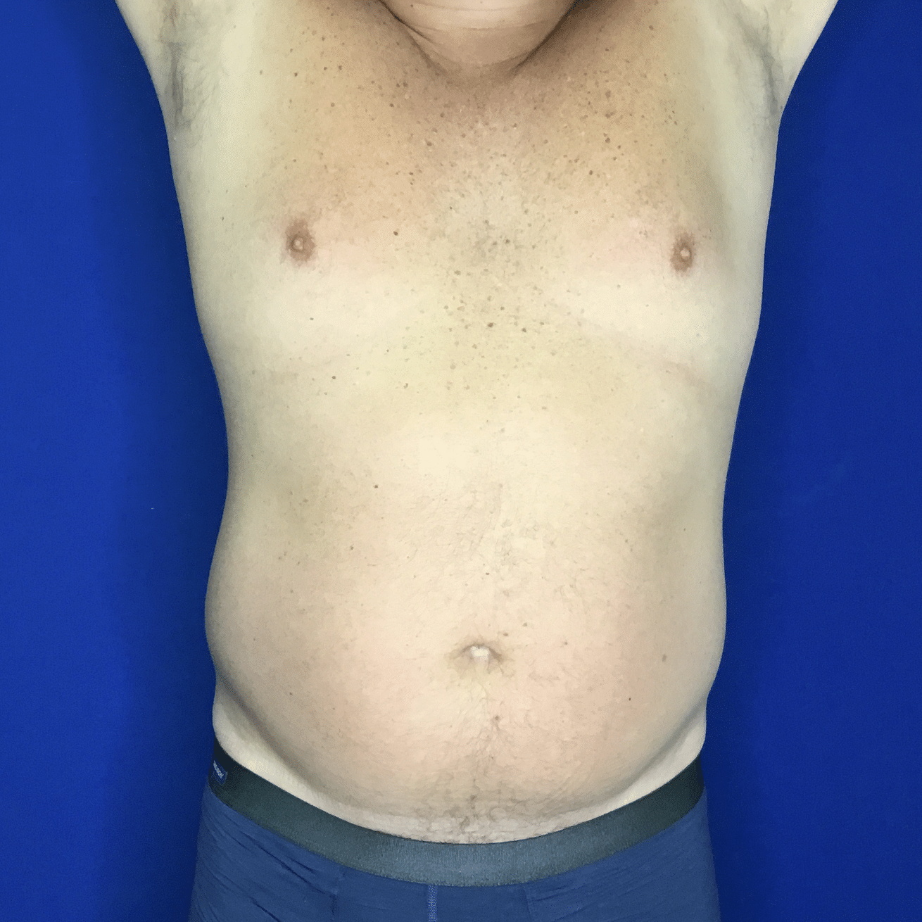A Man Wearing A Blue Shirt